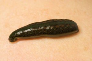 Hirudo Medicinalis: blodigelns användning inom medicin