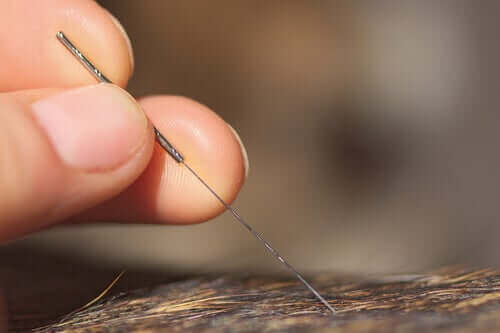 En specialist sticker i en akupunkturnål.