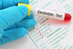 En hand som håller ett provrör där det står "Electrolyte Test"