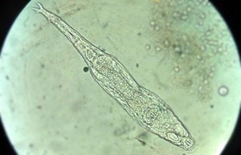 Allt om hjuldjur: En mikroorganism som vaknat till liv efter 24 000 år